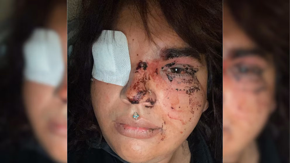 Trans denuncia haber sufrido agresión grupal