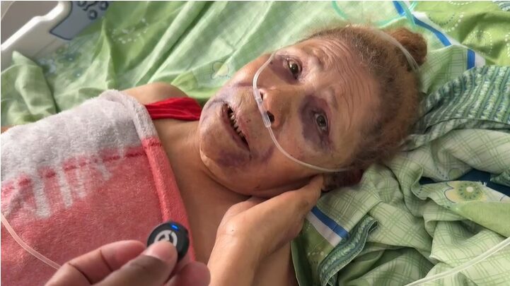Anciana de 86 años es golpeada por haitianos y le prenden