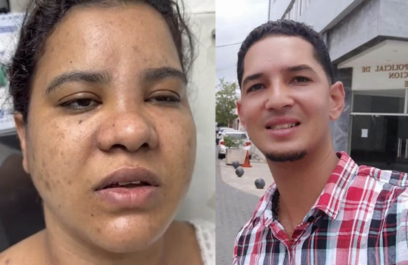 Padres denuncia brutal agresión de su hija por parte de su pareja en Moca