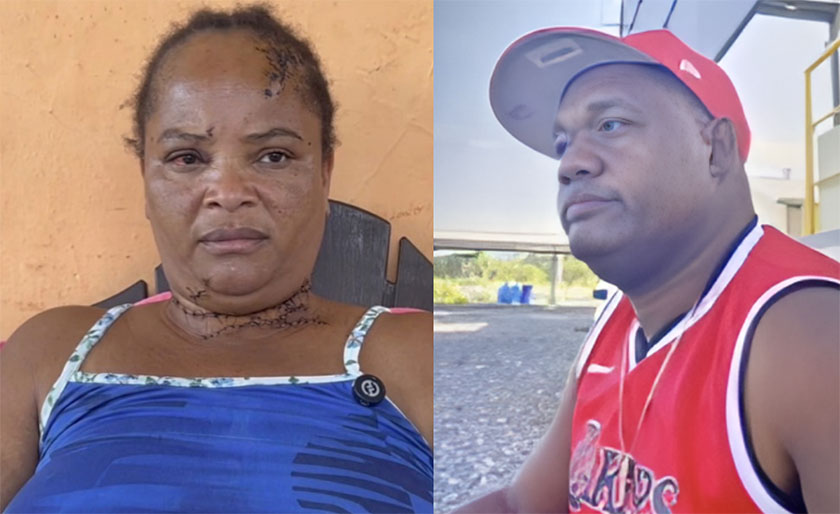 Mujer fue atacada por su expareja en Azua