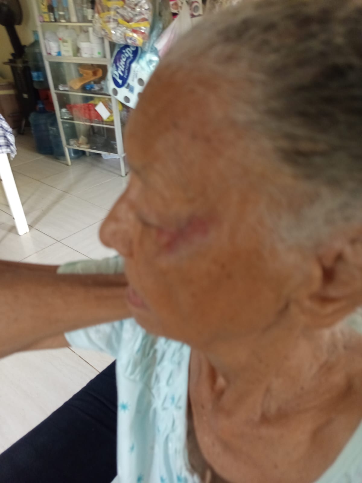 Adulta mayor de 84 años denuncia agresión