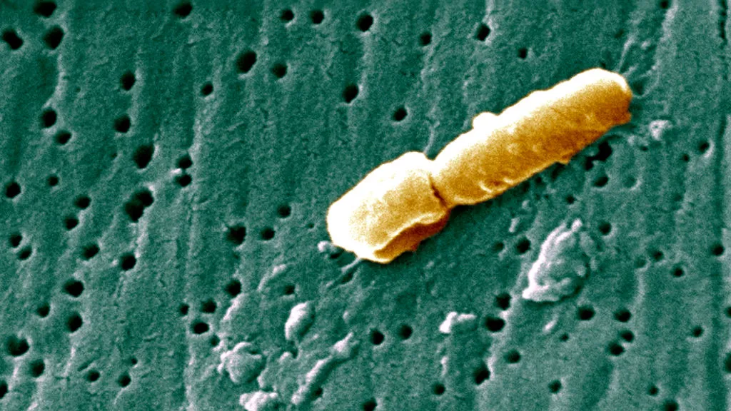 Una mujer contrajo una infección urinaria. Dos años después, la bacteria llegó a su cerebro