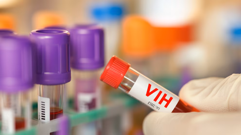 República Dominicana registra epidemia de VIH, según la OPS