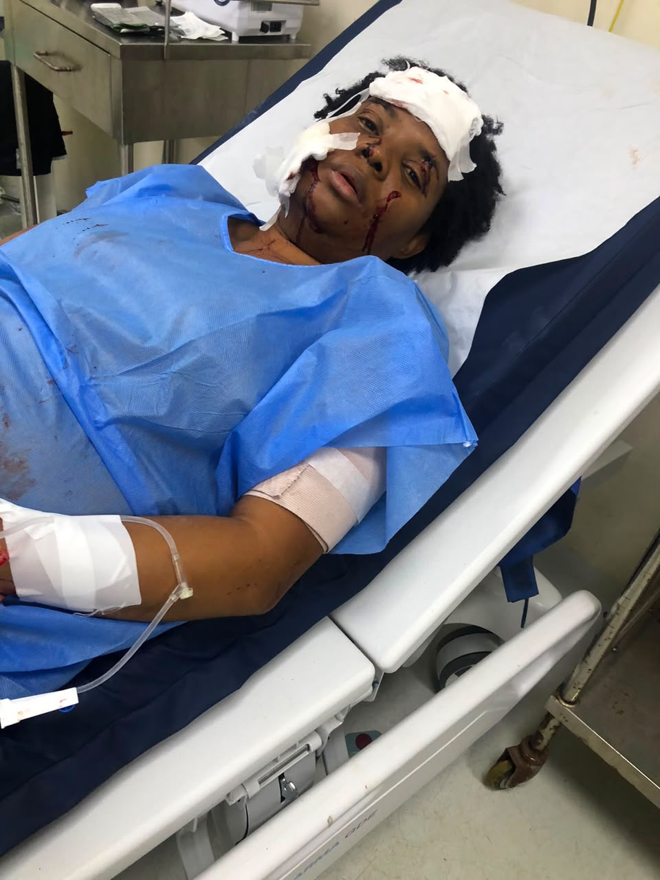 Mujer permanece hospitalizada tras presunta agresión en Los Alcarrizos