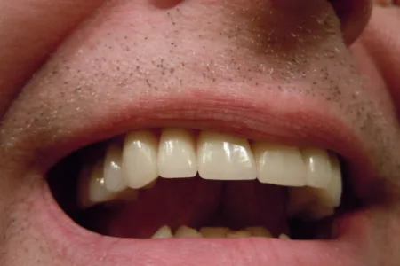 Tecnología y periodoncia: los avances que cambian la odontología