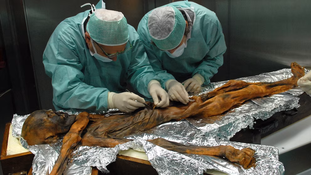 A 35 años del hallazgo de Ötzi, “el hombre de hielo”