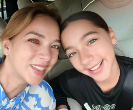 Adamari López explica lo que le pasó en uno de sus ojos
