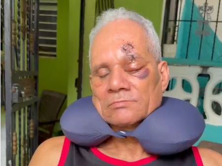 Hombre pierde ojo por agresión de jóvenes a botellazos; pide sean apresados Hombre pierde ojo por agresión de jóvenes a botellazos; pide sean apresados
