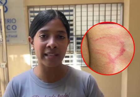 Joven denuncia agresión por diablos cojuelos en Azua; diputada exige frenar agresiones