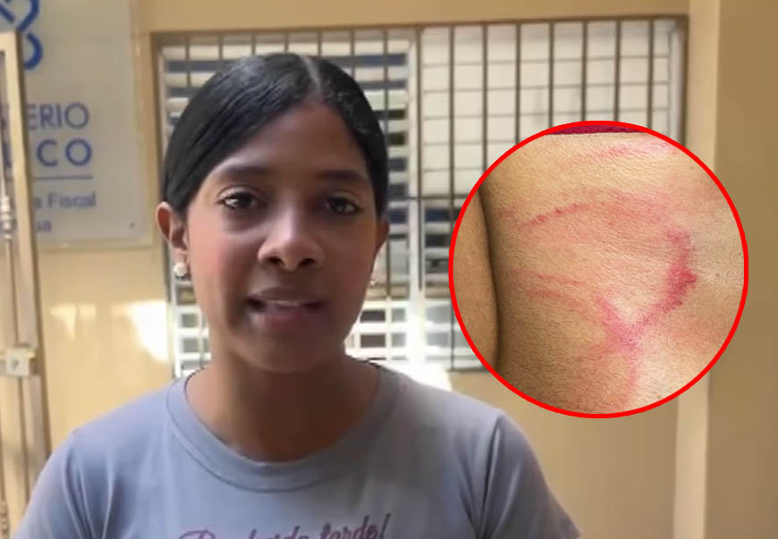 Joven denuncia agresión por diablos cojuelos en Azua; diputada exige frenar agresiones