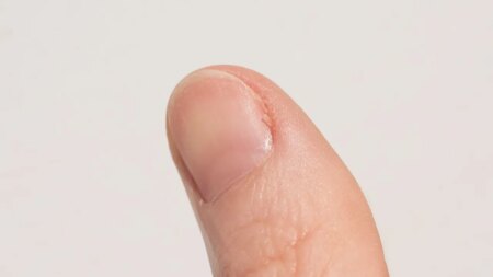 Un pequeño cambio en el color de tus uñas podría estar relacionado con tu salud