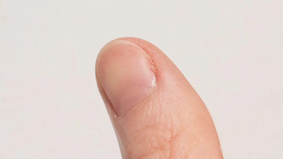 Un pequeño cambio en el color de tus uñas podría estar relacionado con tu salud