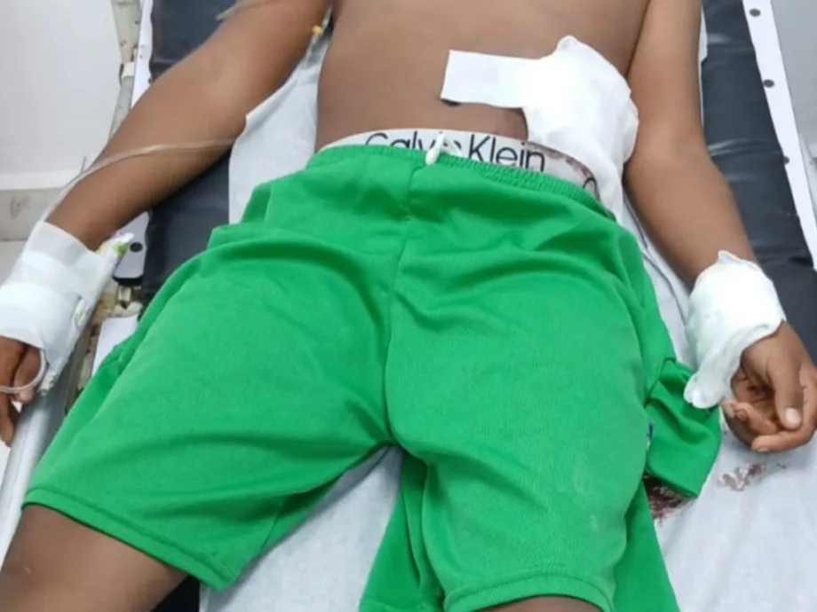 Niño de ocho años resulta herido de bala mientras manipulaba una "chilena" en Barahona