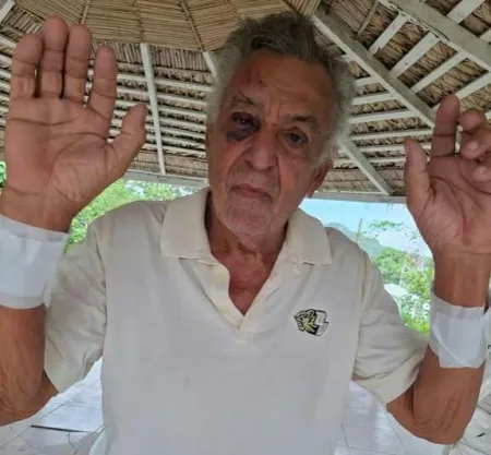 Empresario tabaquero de Altamira es brutalmente golpeado durante asalto en su residencia Empresario tabaquero de Altamira es brutalmente golpeado durante asalto en su residencia
